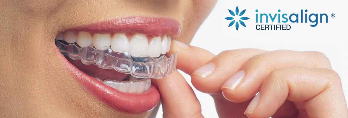 Woman holding teeth with Invisalign clear aligners, smiling confidently.