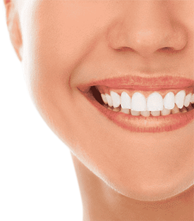 Smiling woman showcasing her bright white teeth, exuding positivity.