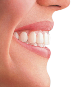 Portrait of a woman with braces flashing a bright smile.